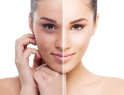 Conheça os 9 benefícios do Peeling Enziamático